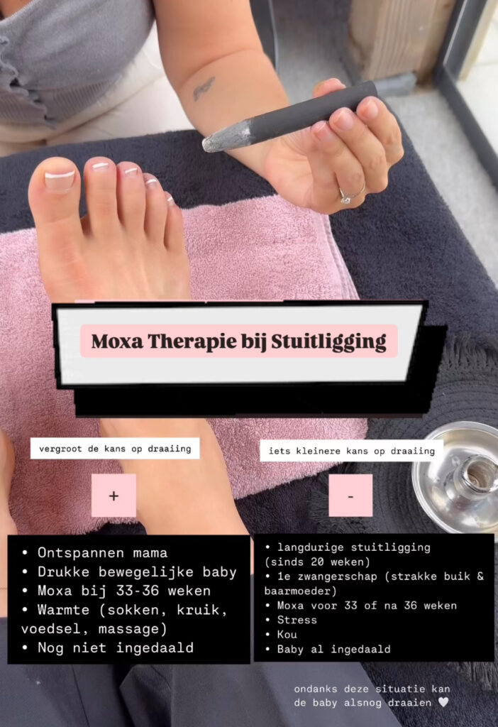moxa therapie bij stuitligging is een risisco vrije en pijnloze manier om een kindje van stuit in de juiste richtng te draaien, wanneer je dit toepast tussen 33 en 36 weken zwangerschap.